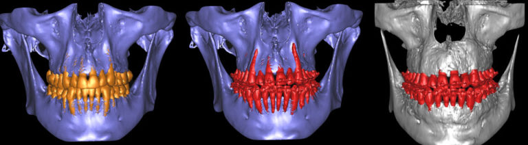 Orthodontic Digital Planning 