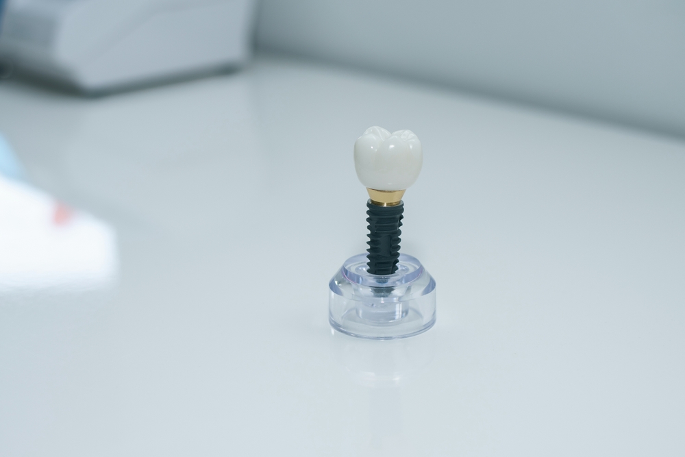 Dentist consulting with a patient about dental implants